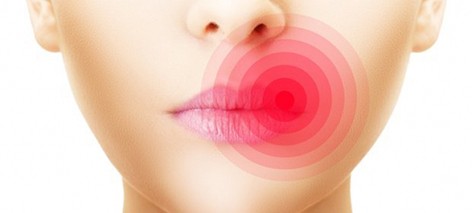 Доктор рассказал, как снизить частоту рецидивов герпеса на губах