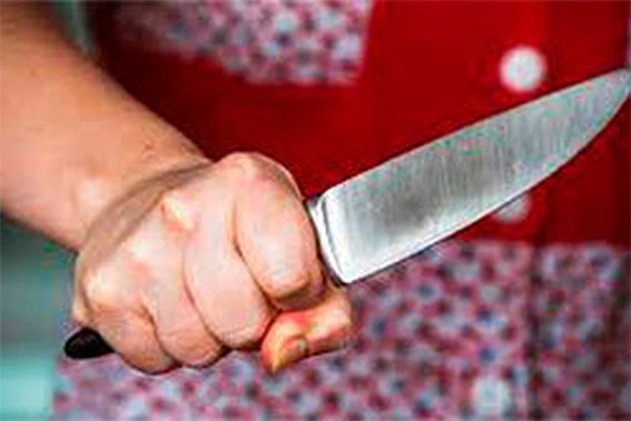 Быховчанка нанесла ножевое ранение мужу во время ссоры