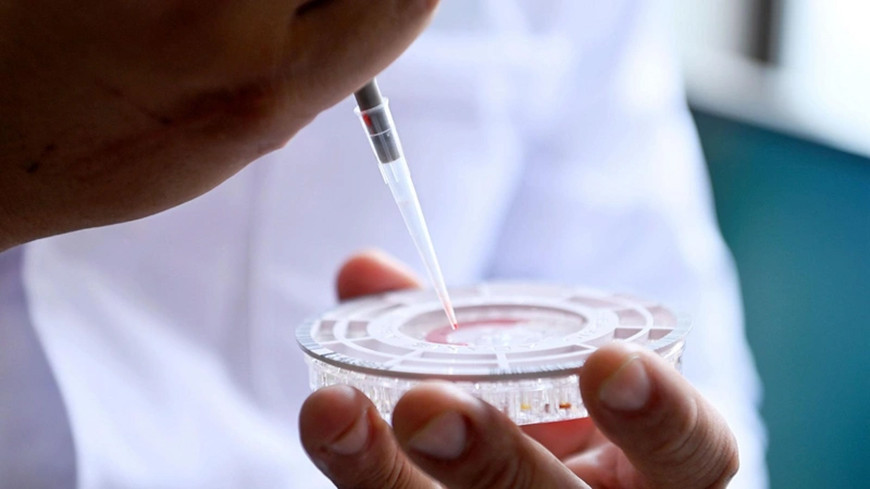 Российские ученые создали первый в мире быстрый тест для диагностики гепатита С