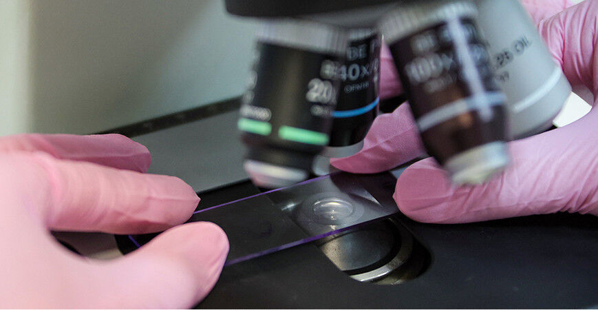 «Это сотни, тысячи спасенных жизней». Глава Академии наук о новых разработках в онкологии 