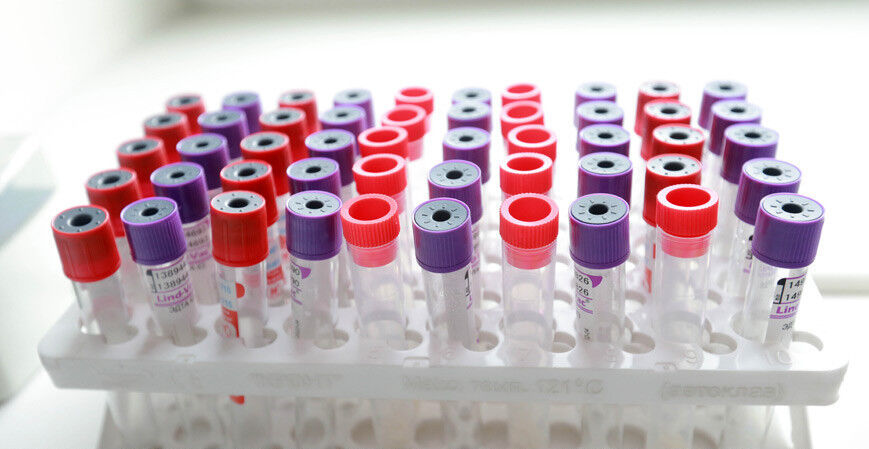 Белорусские учёные создали тест-систему для одновременного выявления гриппа и коронавируса