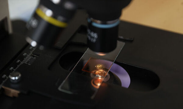 В Беларуси создали уникальный биочип для диагностики аллергии